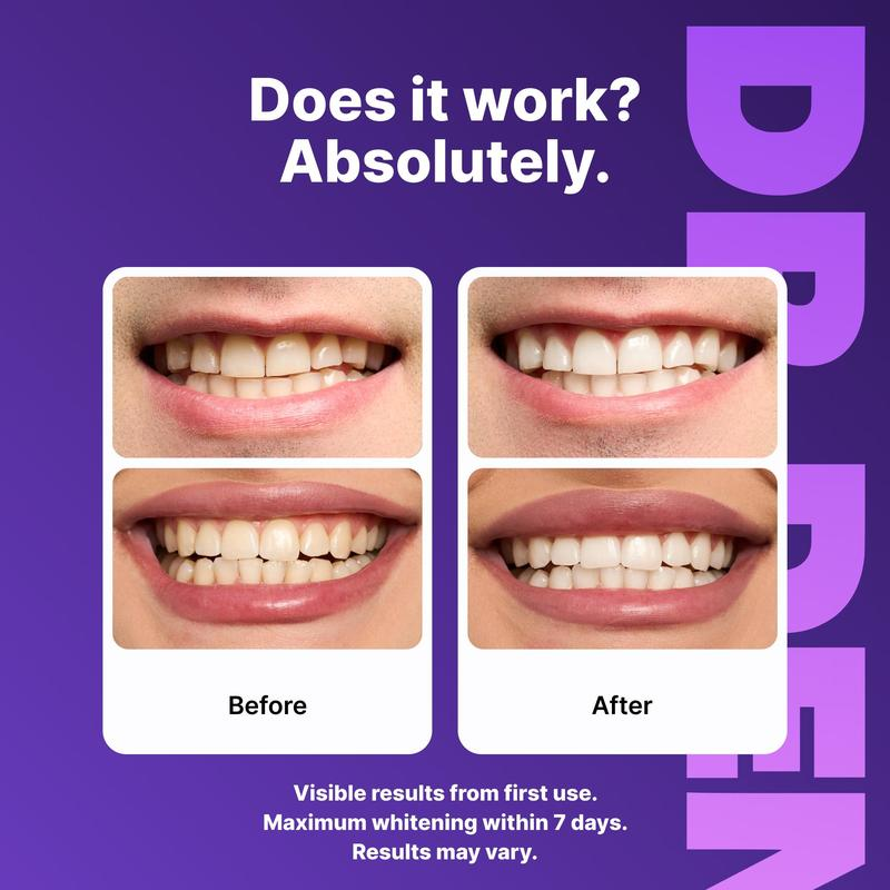 Smileora™ Purple Whitening Strips